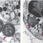 A healthy immune system can defeat invading pathogens as shown above, where two bacteria are no match for the white blood cell that engulfs and kills them